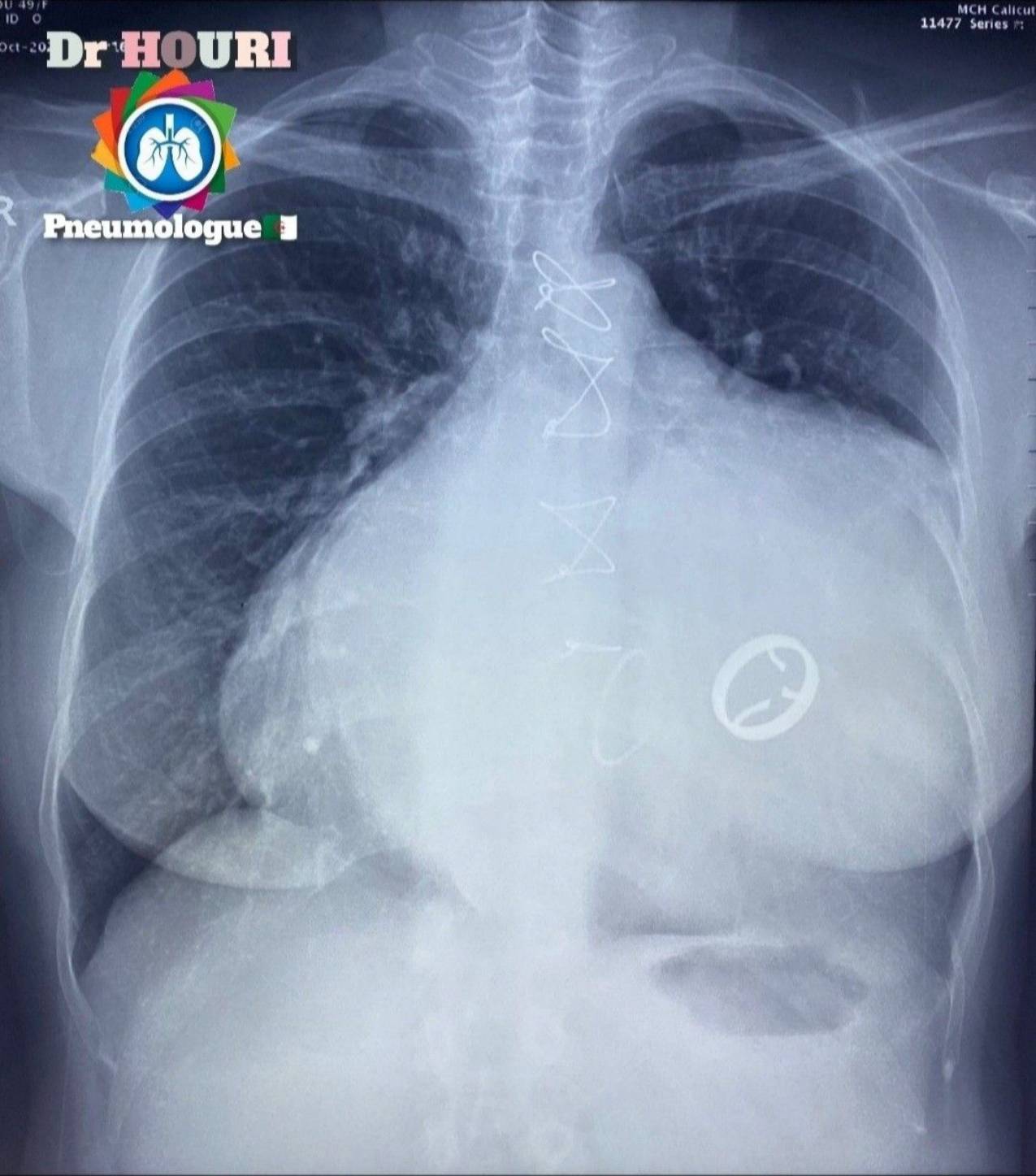 Radiologie 5