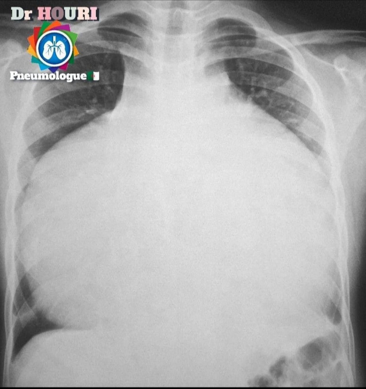 Radiologie 6