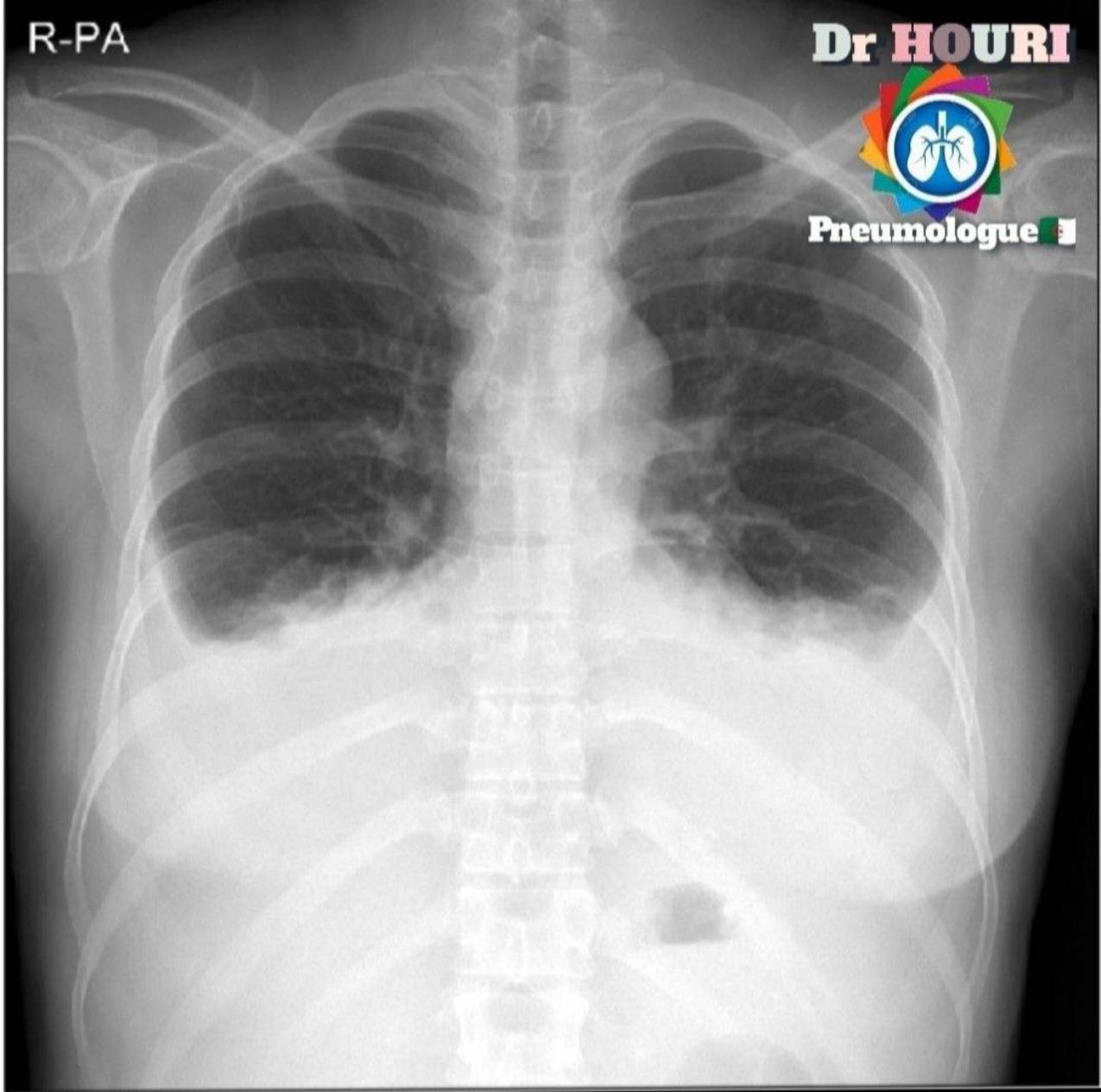 Radiologie 11