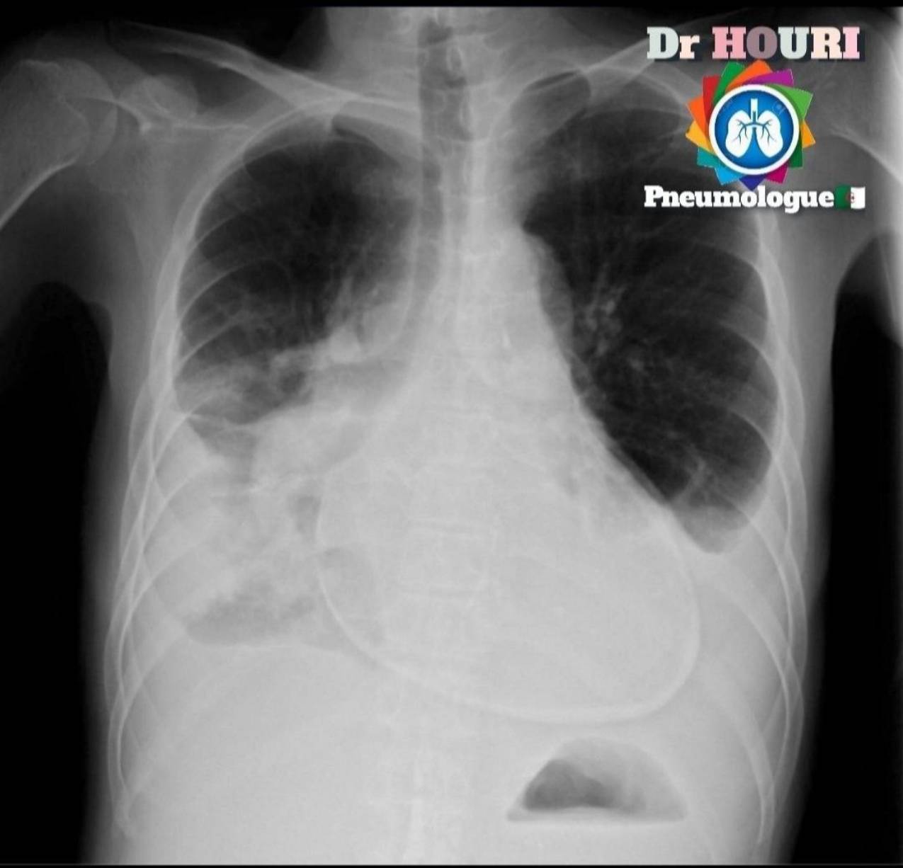 Radiologie 12