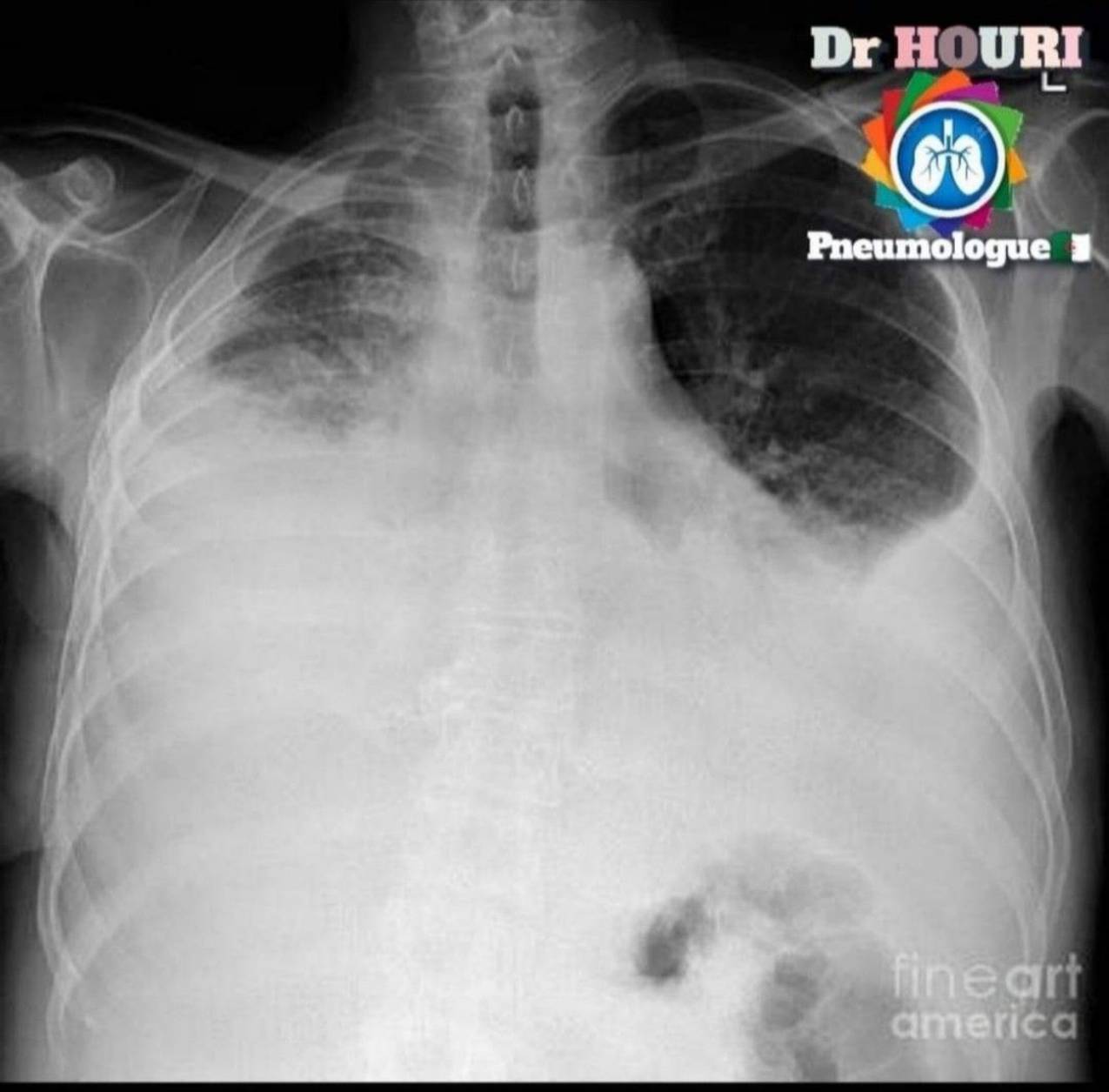 Radiologie 13