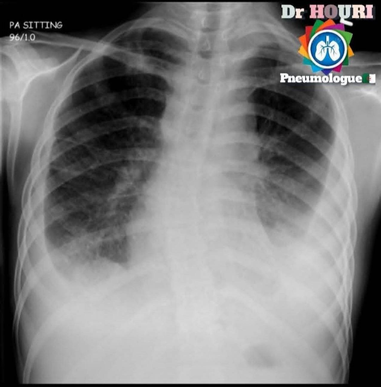 Radiologie 15