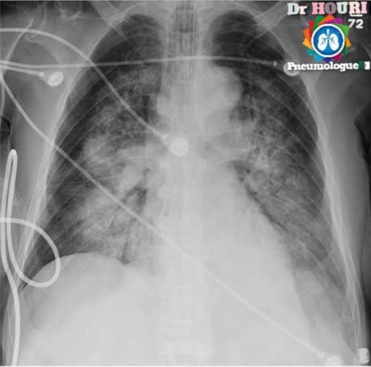 Radiologie 18