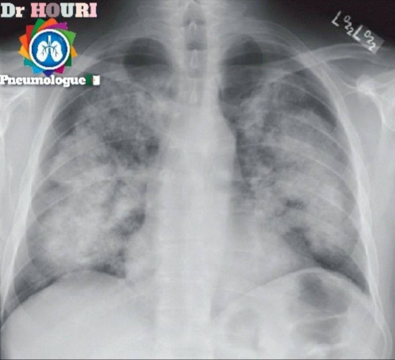 Radiologie 19