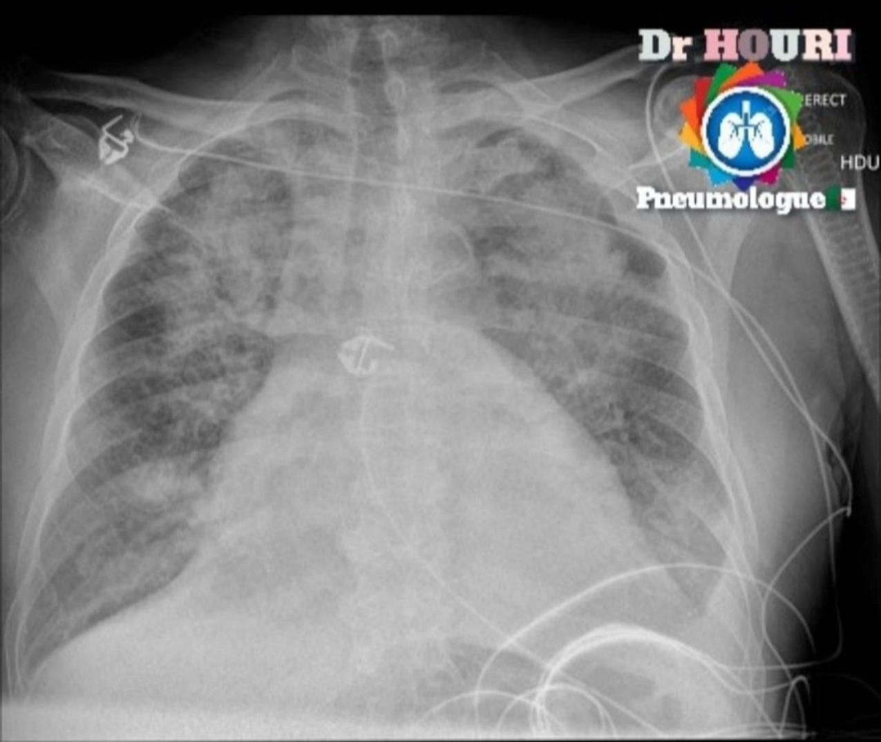 Radiologie 20