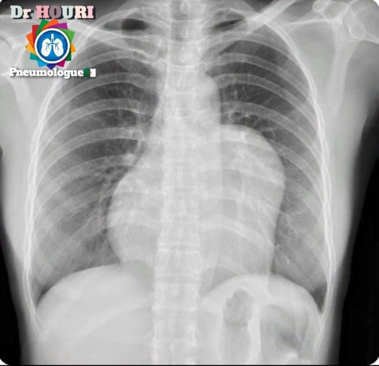 Radiologie 25