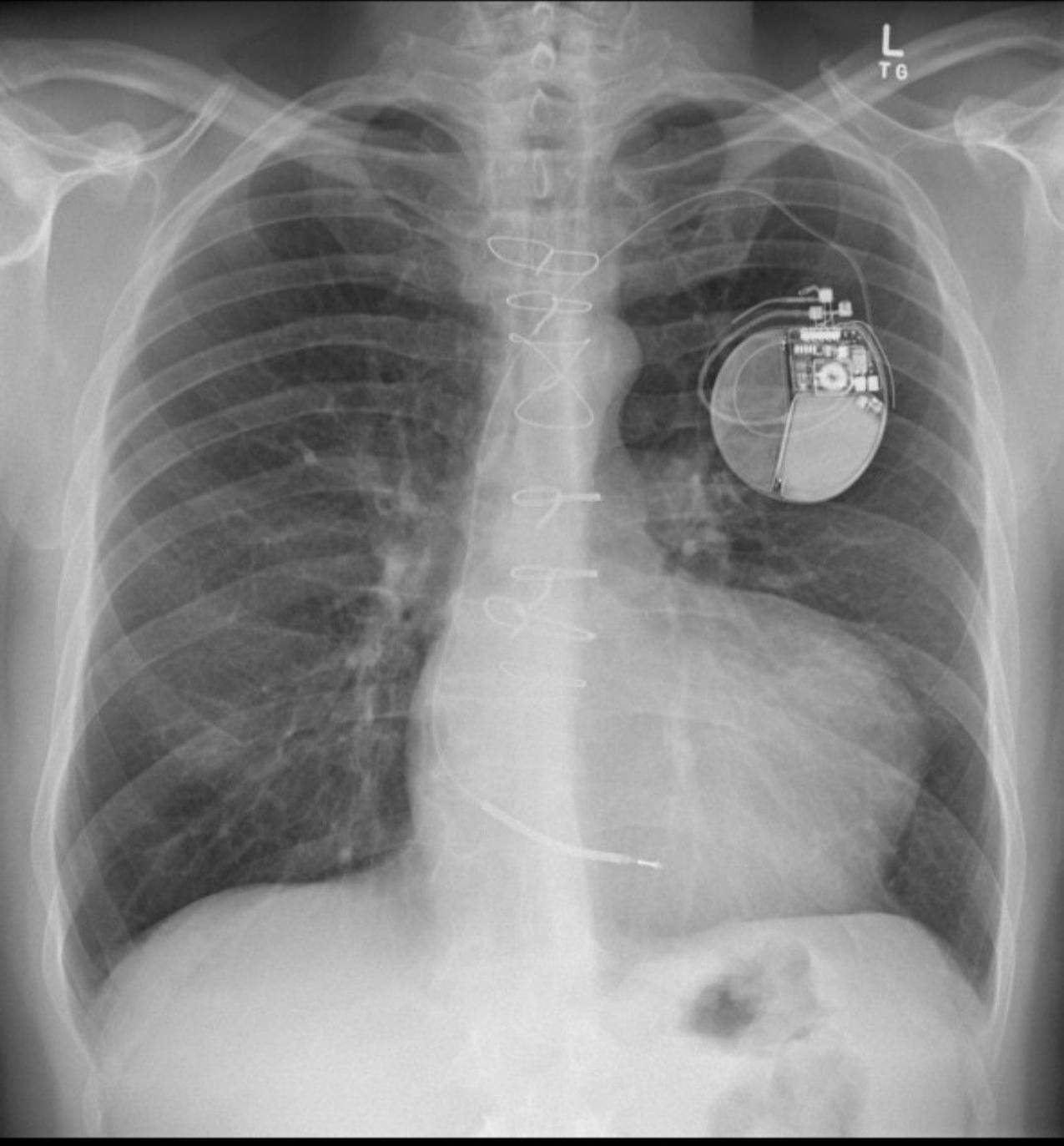 Radiologie 26