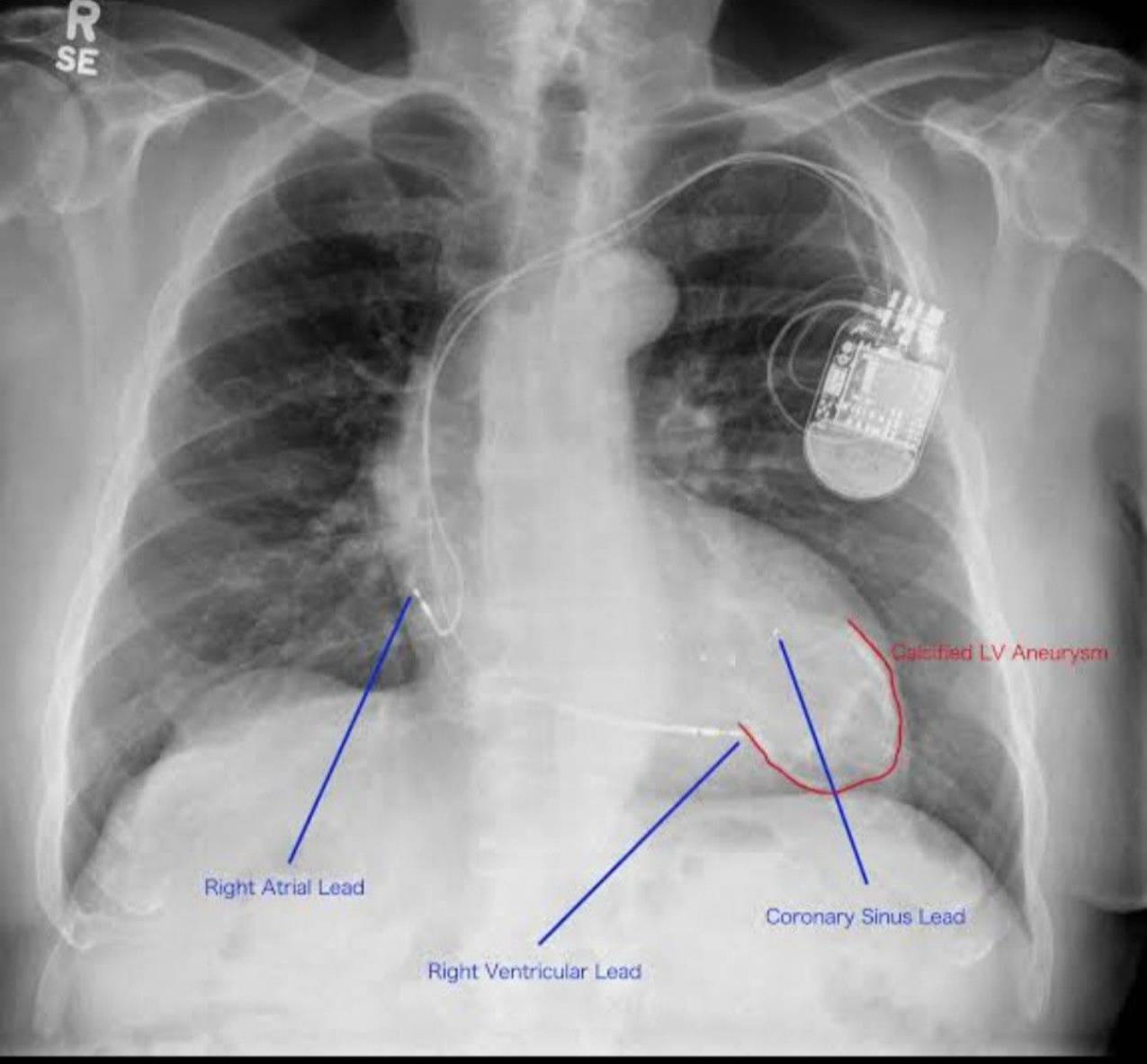 Radiologie 27