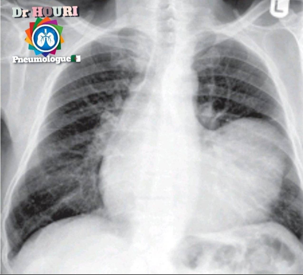 Radiologie 28