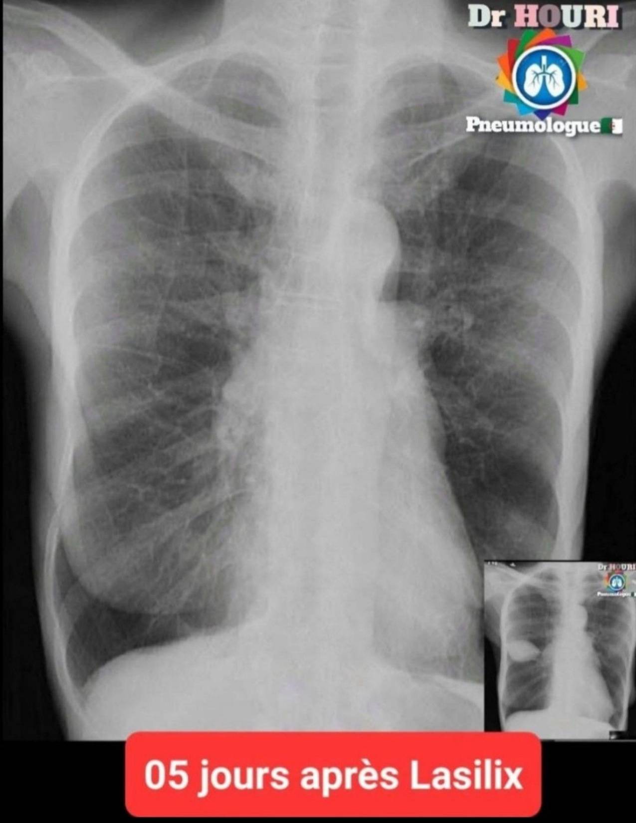 Radiologie 32