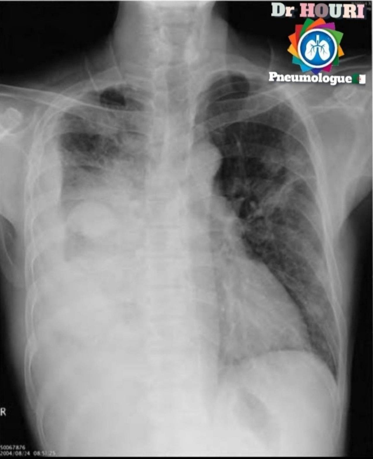 Radiologie 33