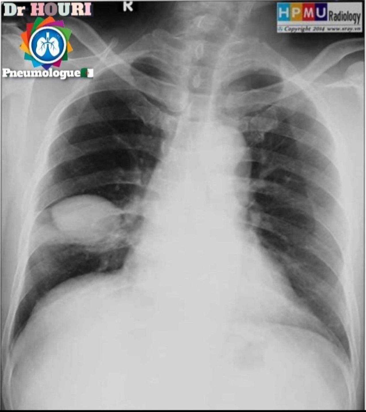 Radiologie 34