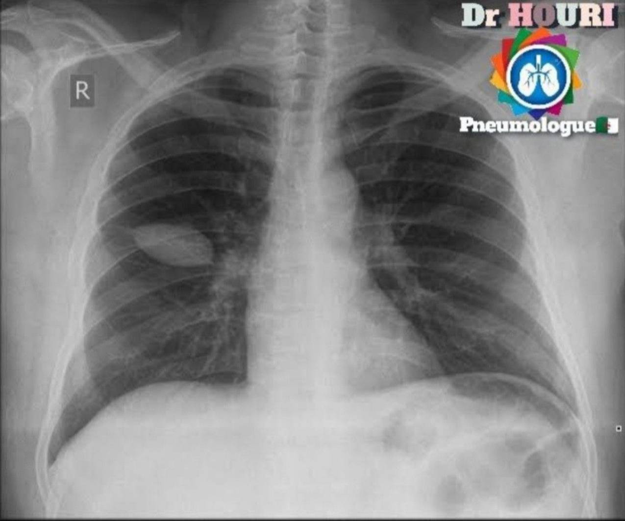 Radiologie 35