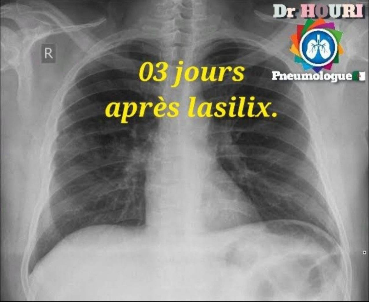 Radiologie 36