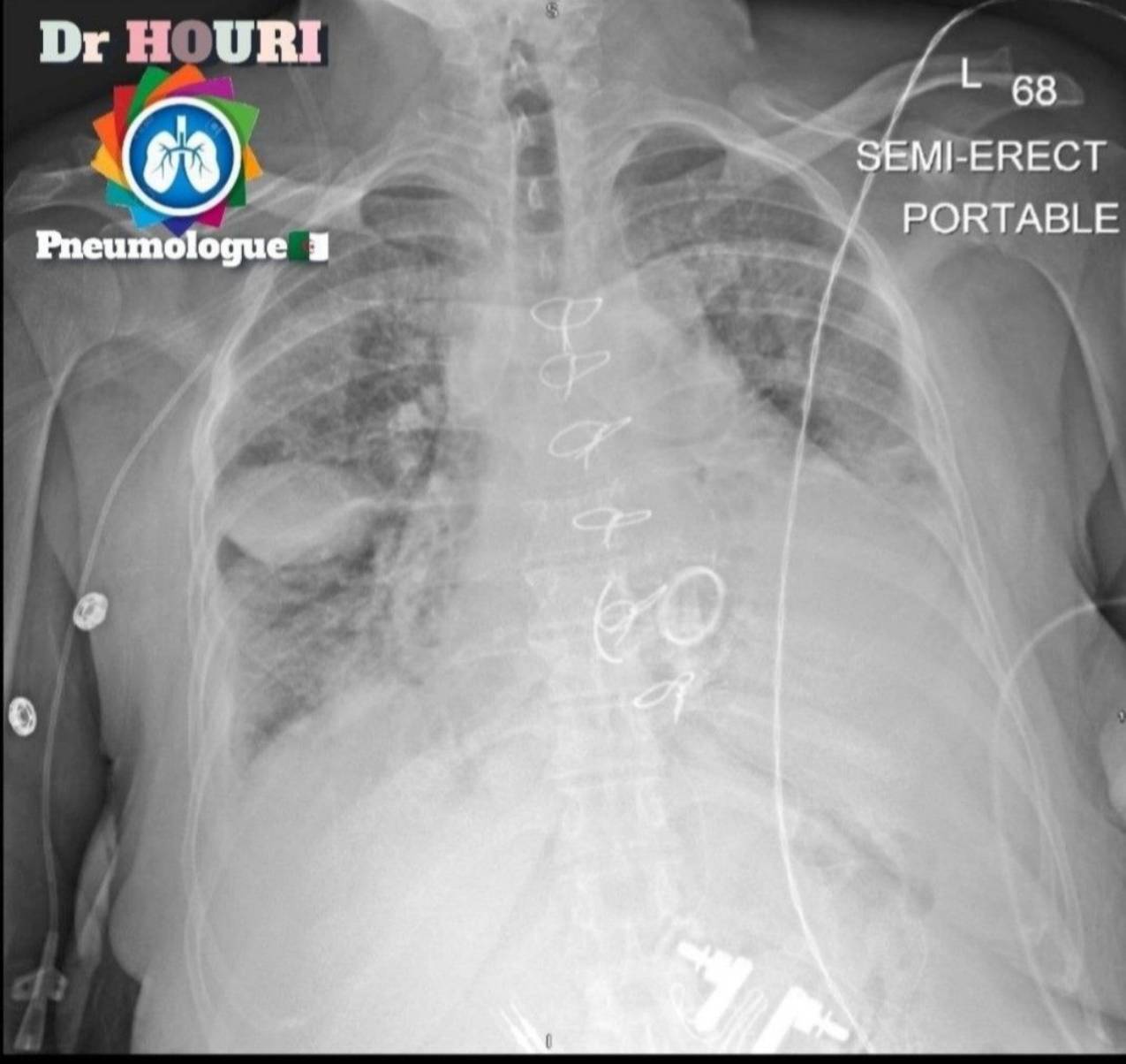 Radiologie 37