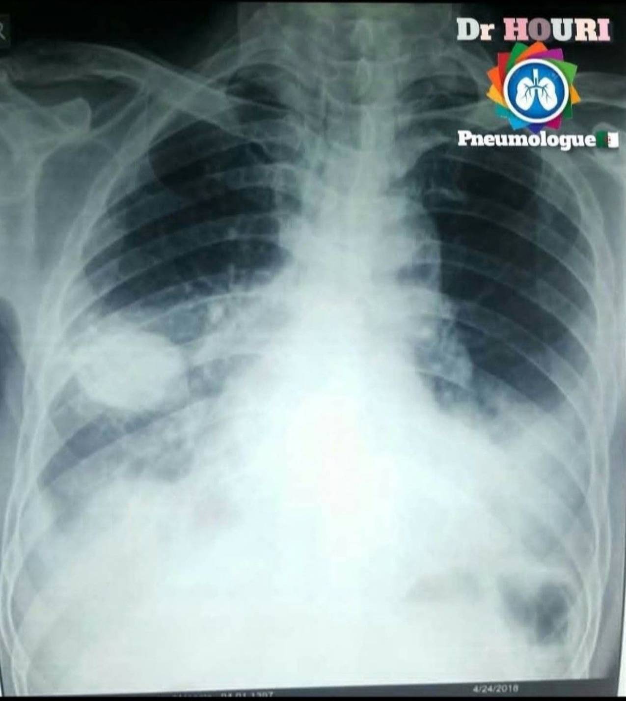 Radiologie 38