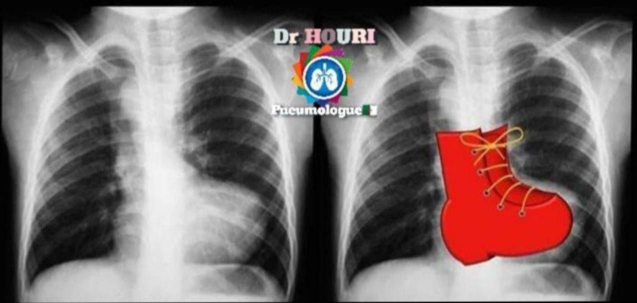 Radiologie 41