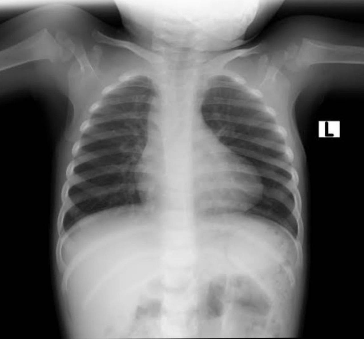 Radiologie 43