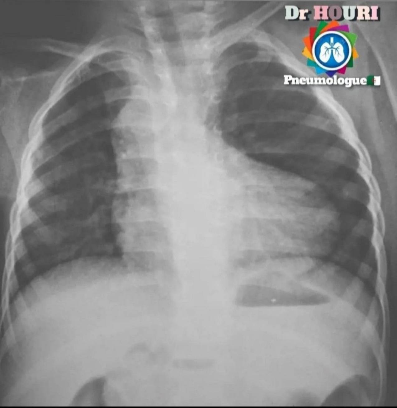 Radiologie 44
