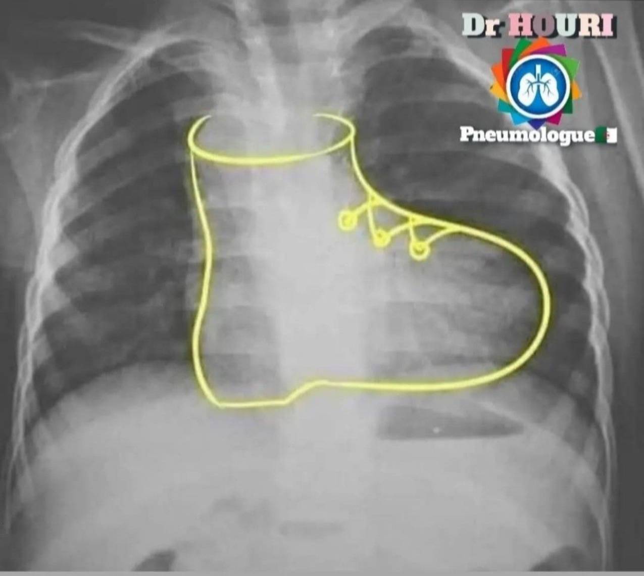 Radiologie 45