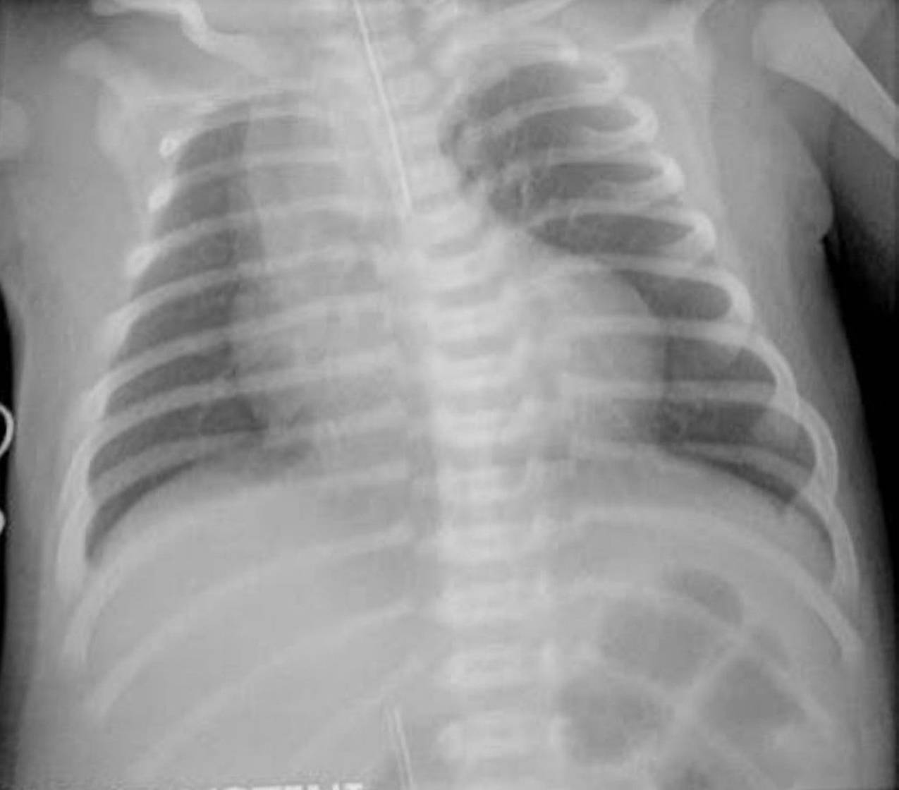 Radiologie 46