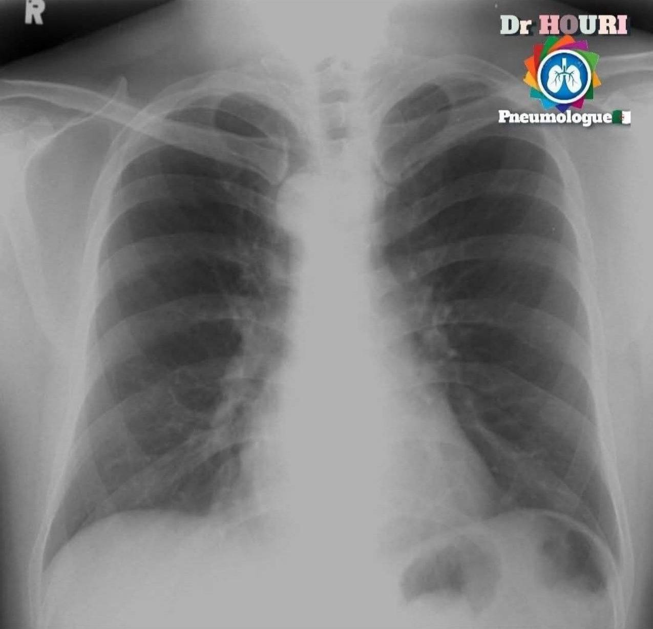 Radiologie 49