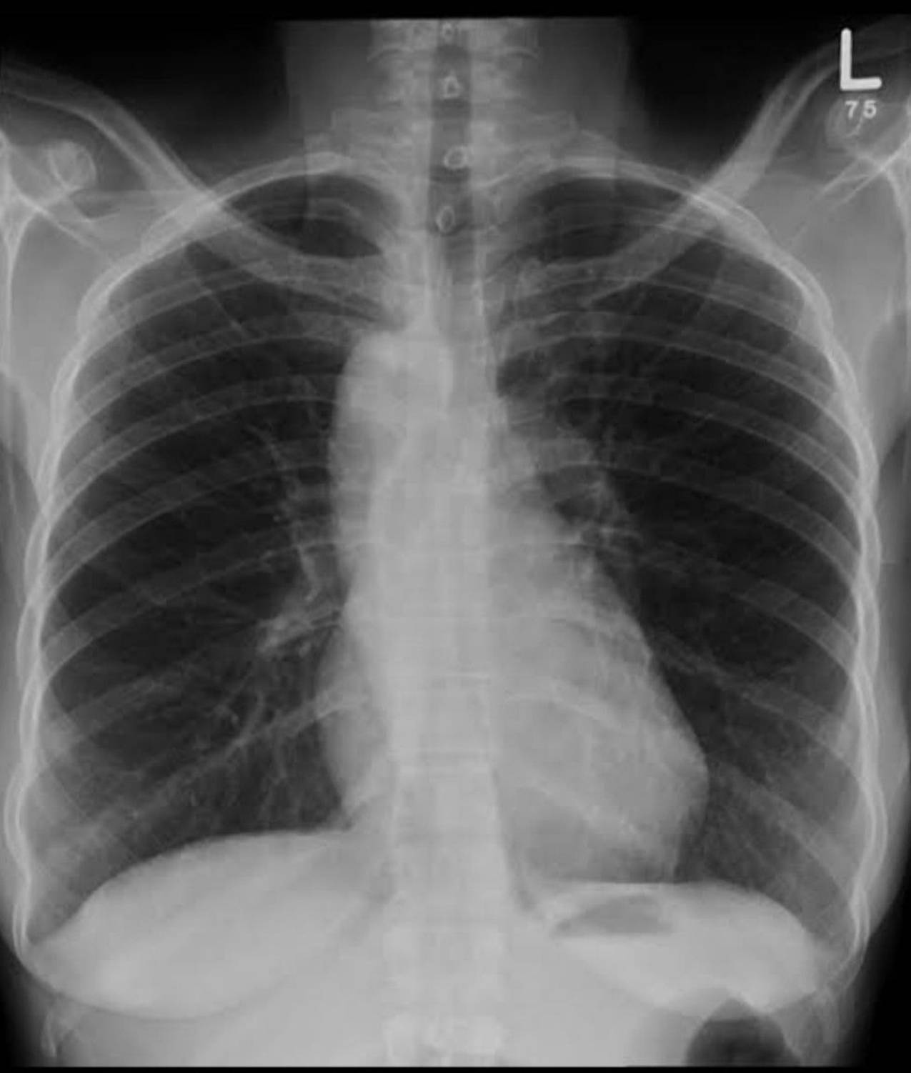 Radiologie 50