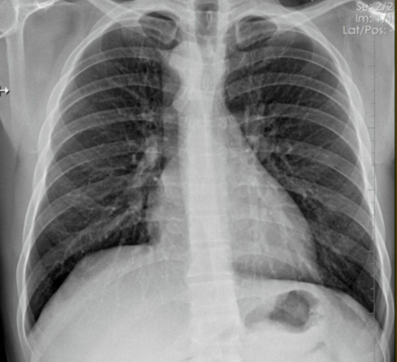 Radiologie 51