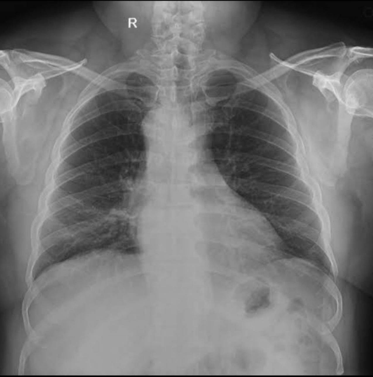 Radiologie 52
