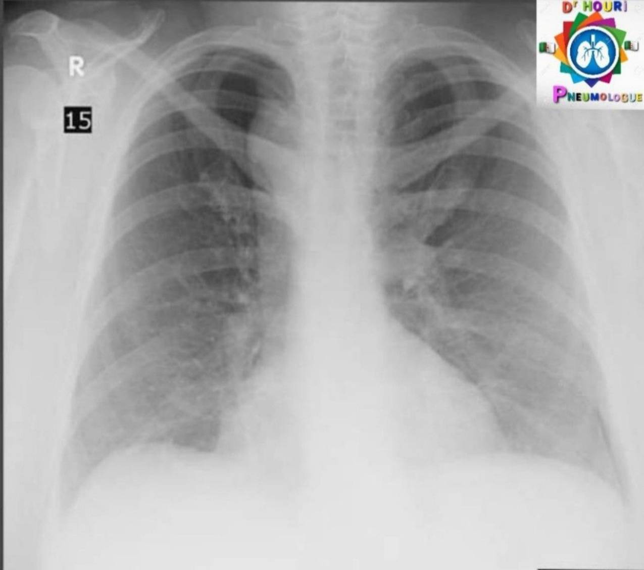 Radiologie 53