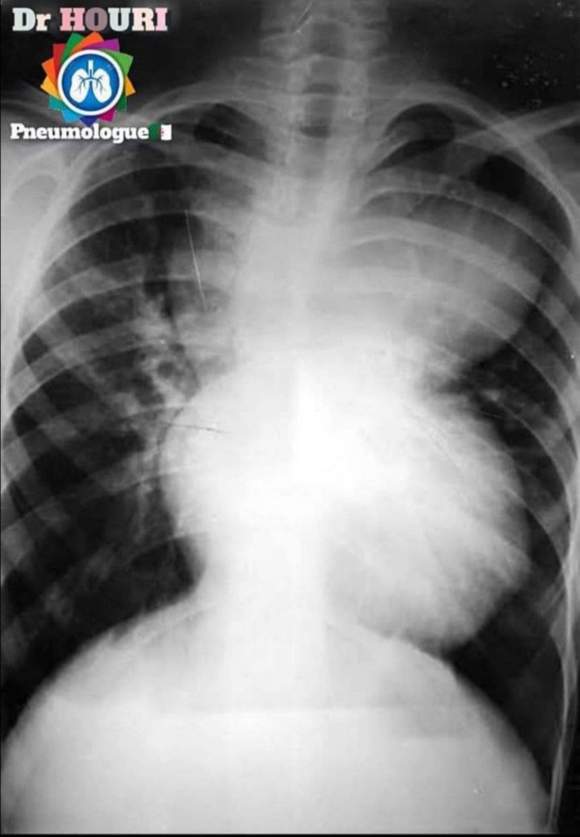 Radiologie 56
