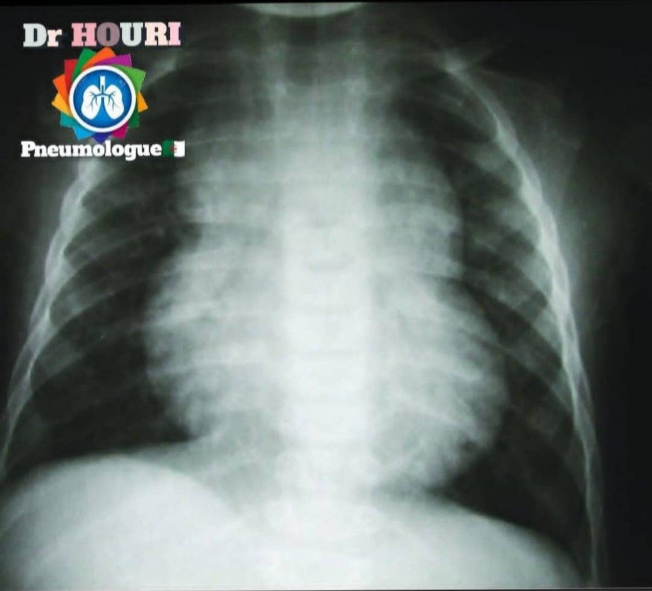 Radiologie 58