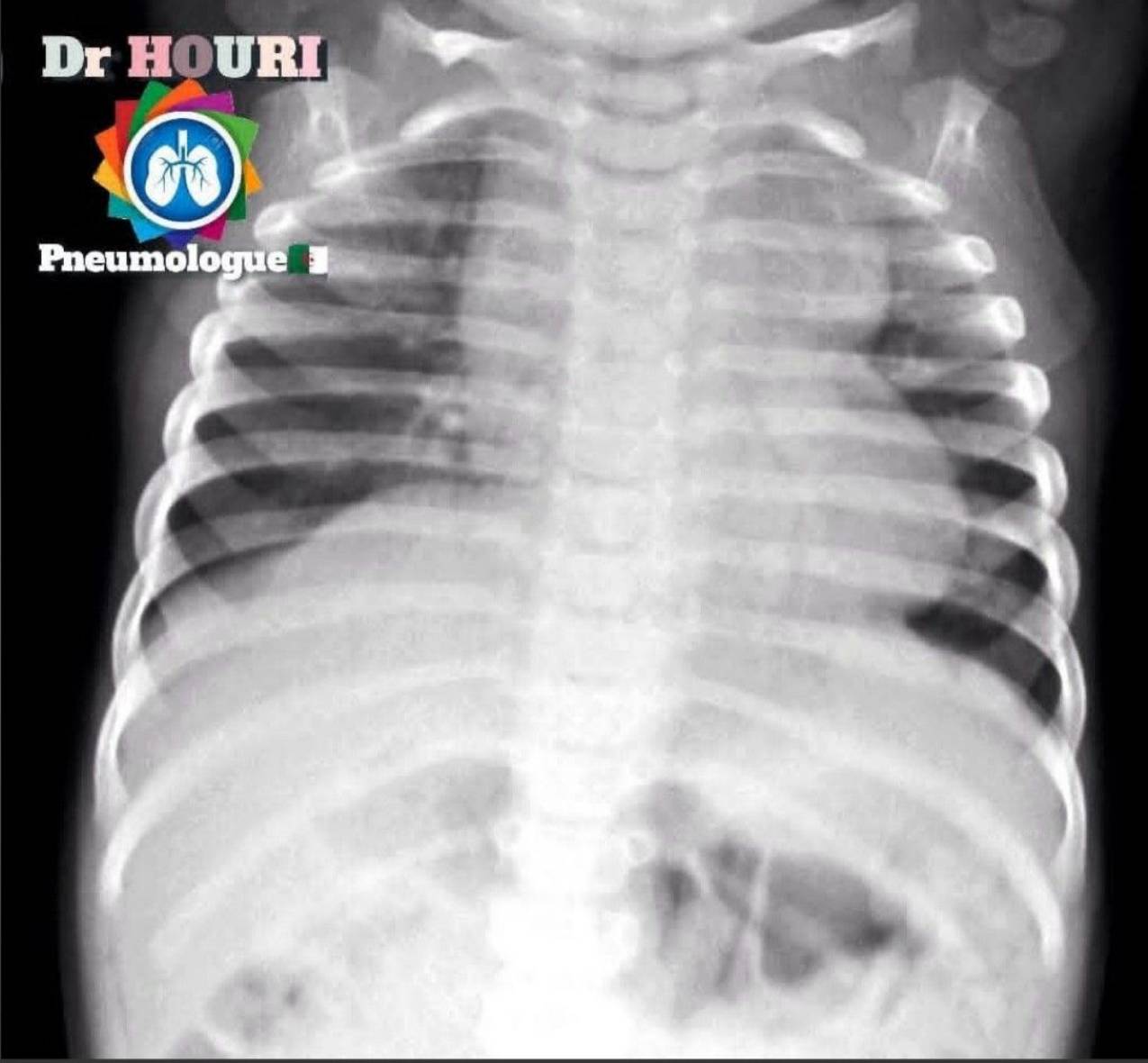 Radiologie 59