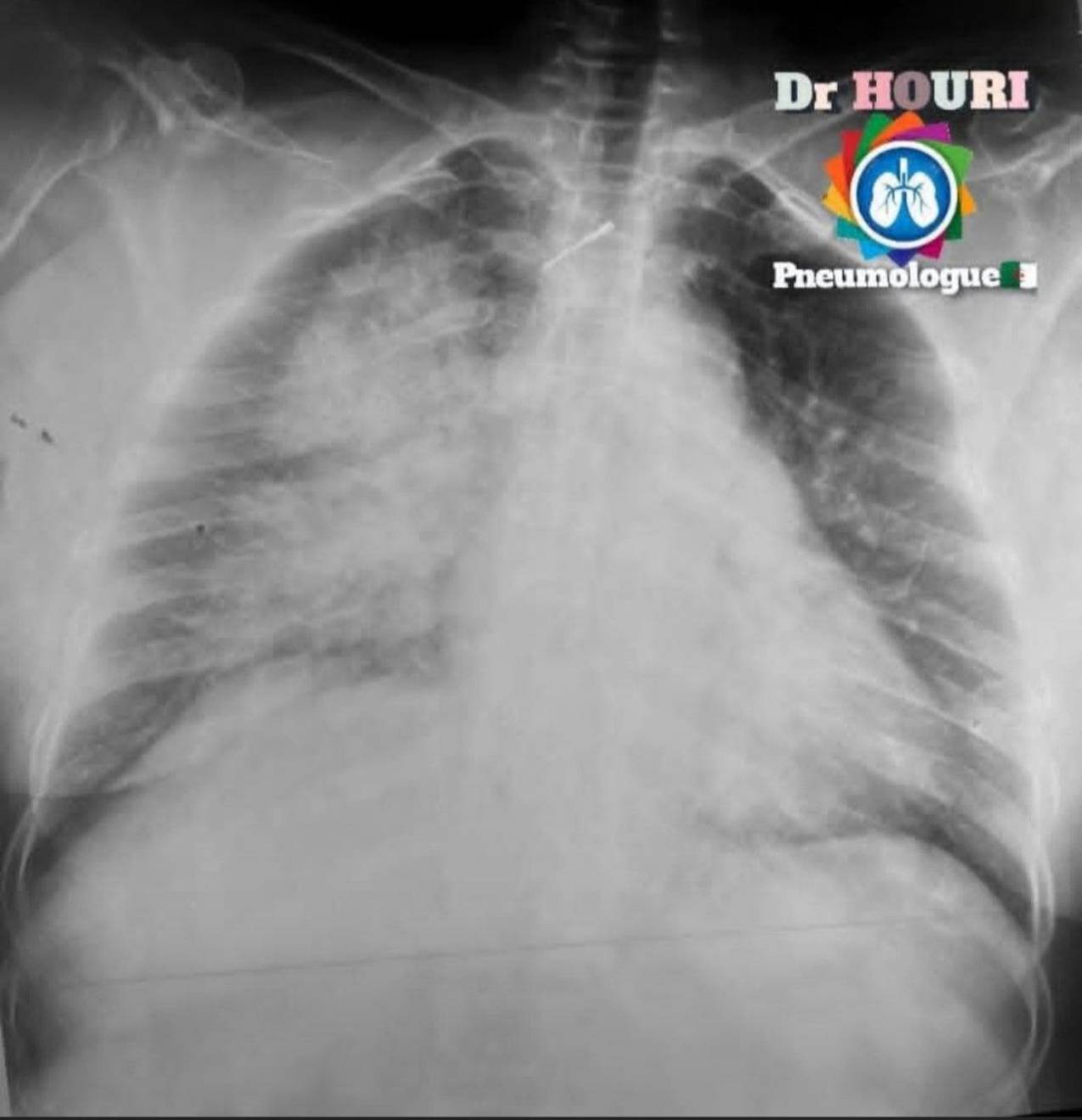 Radiologie 62