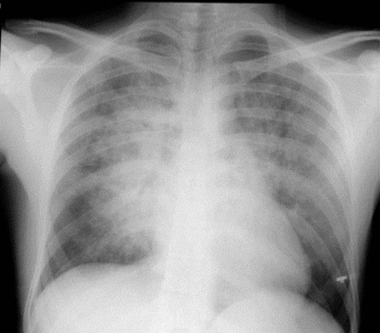 Radiologie 63