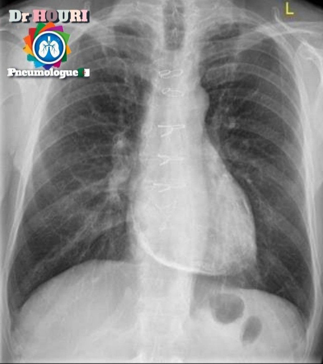 Radiologie 66