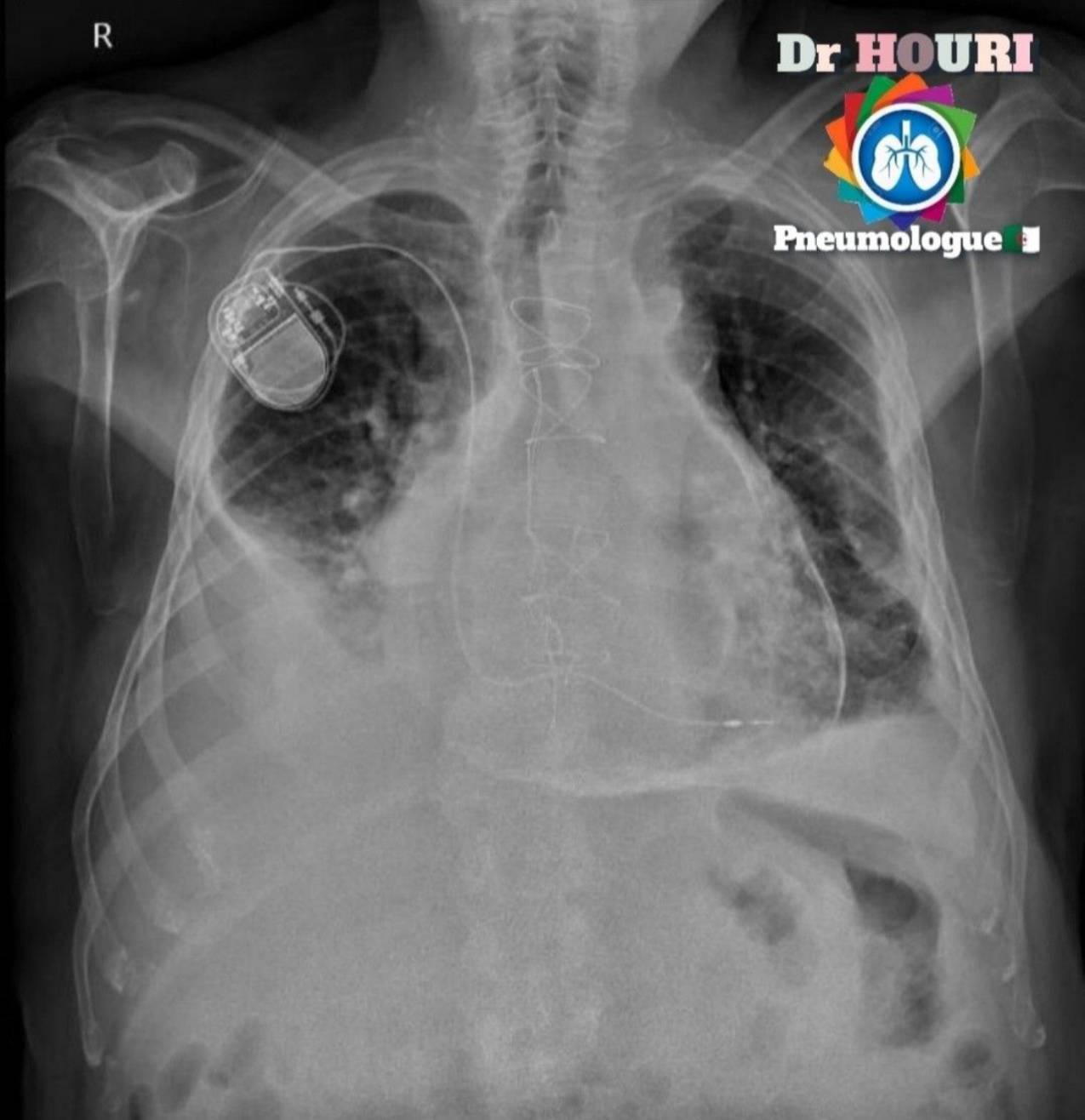Radiologie 67
