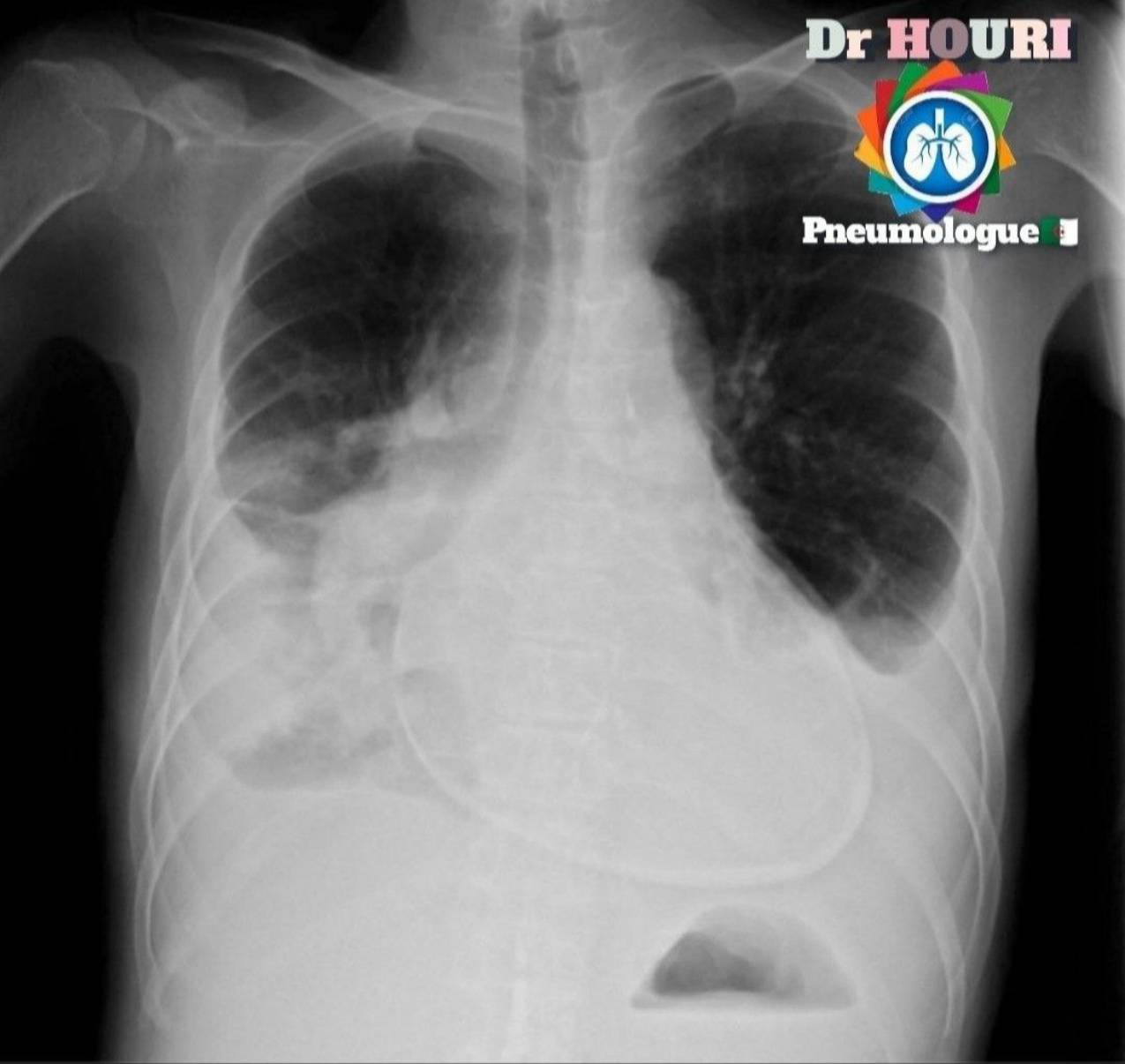 Radiologie 68