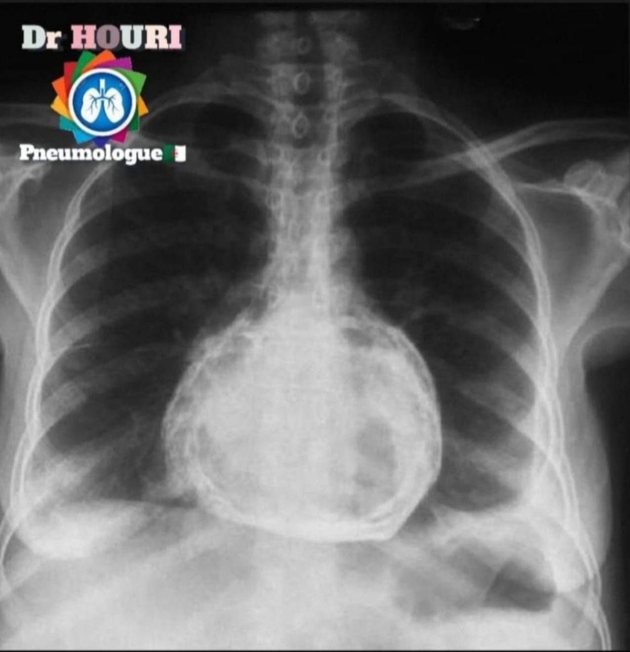 Radiologie 69