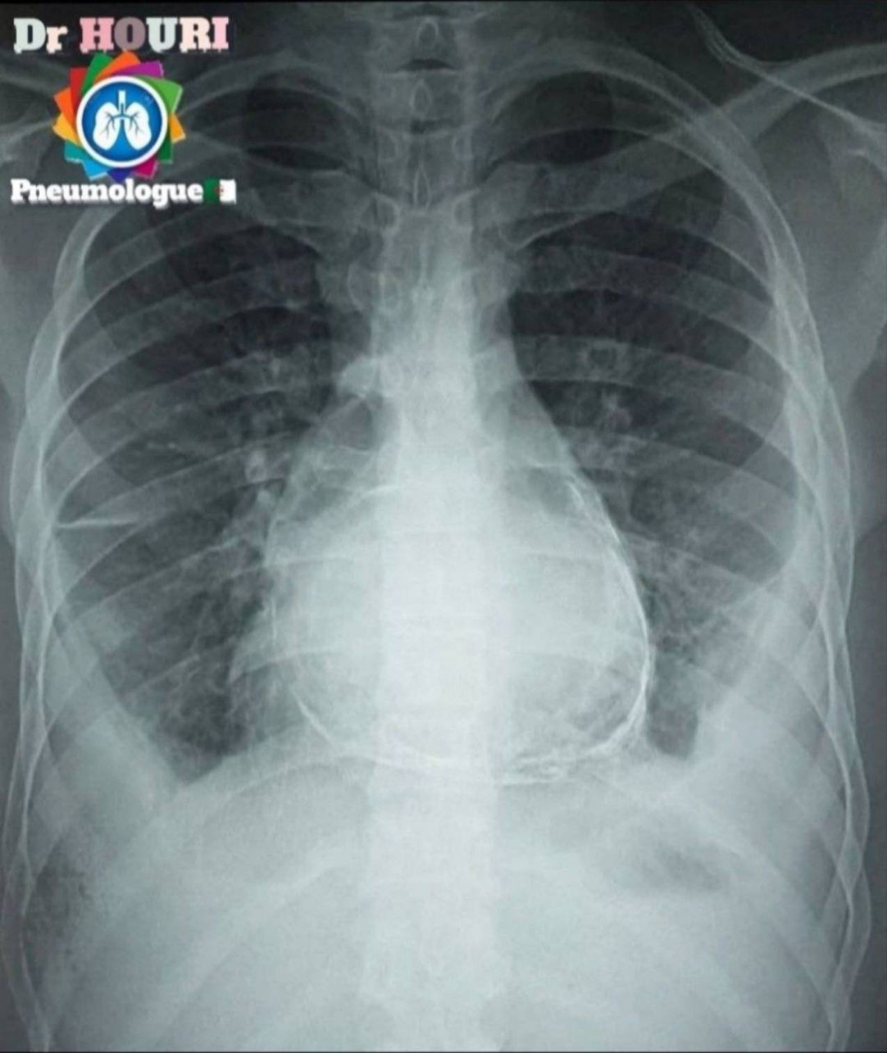 Radiologie 70