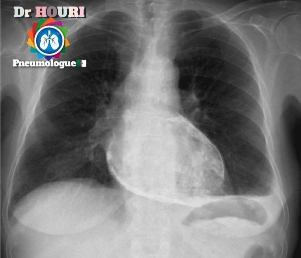Radiologie 71