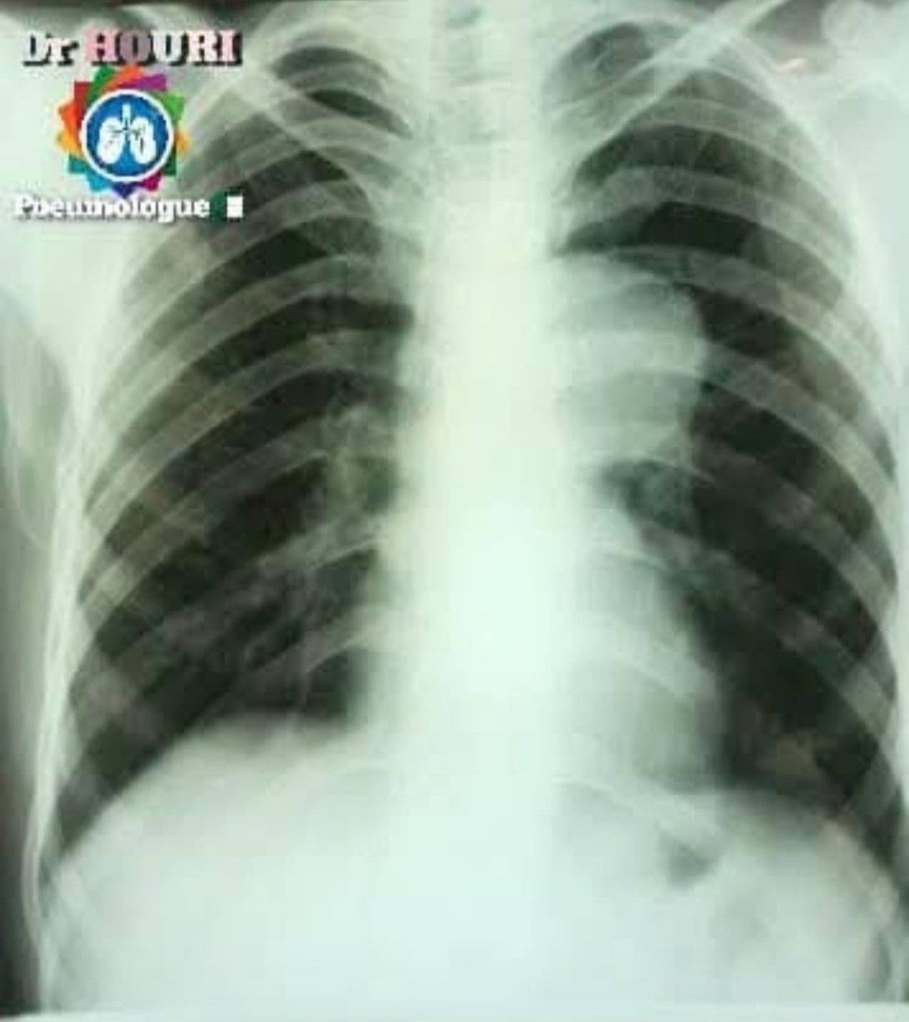 Radiologie 75