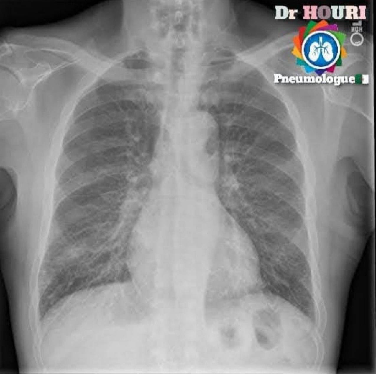Radiologie 78