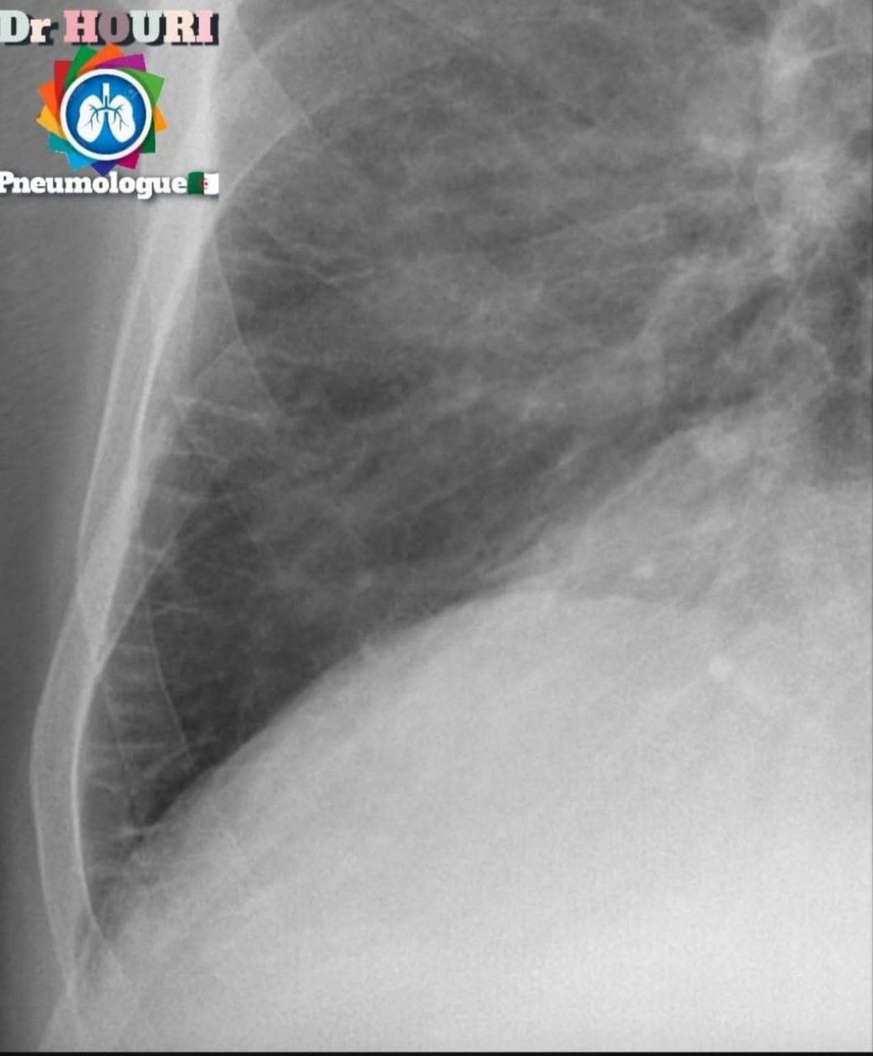 Radiologie 79