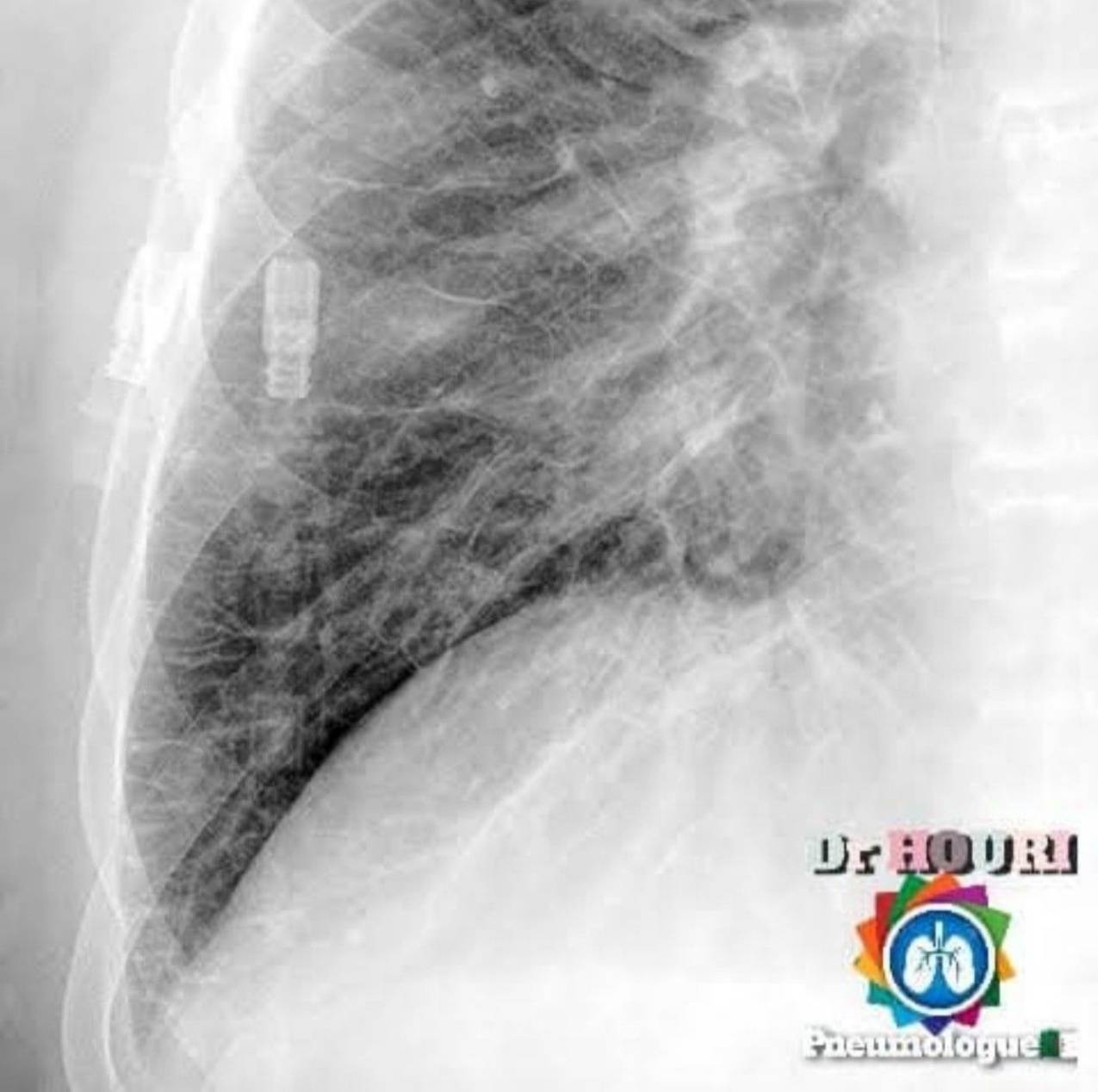 Radiologie 80