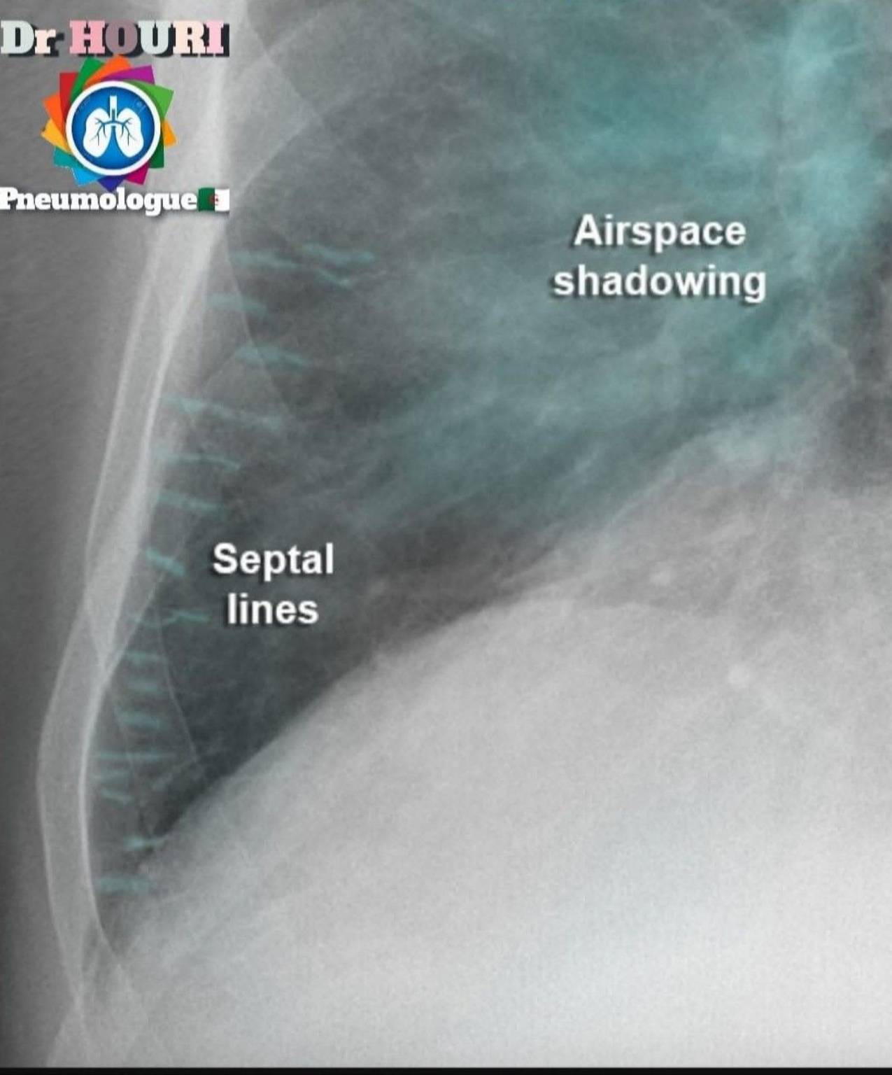 Radiologie 81