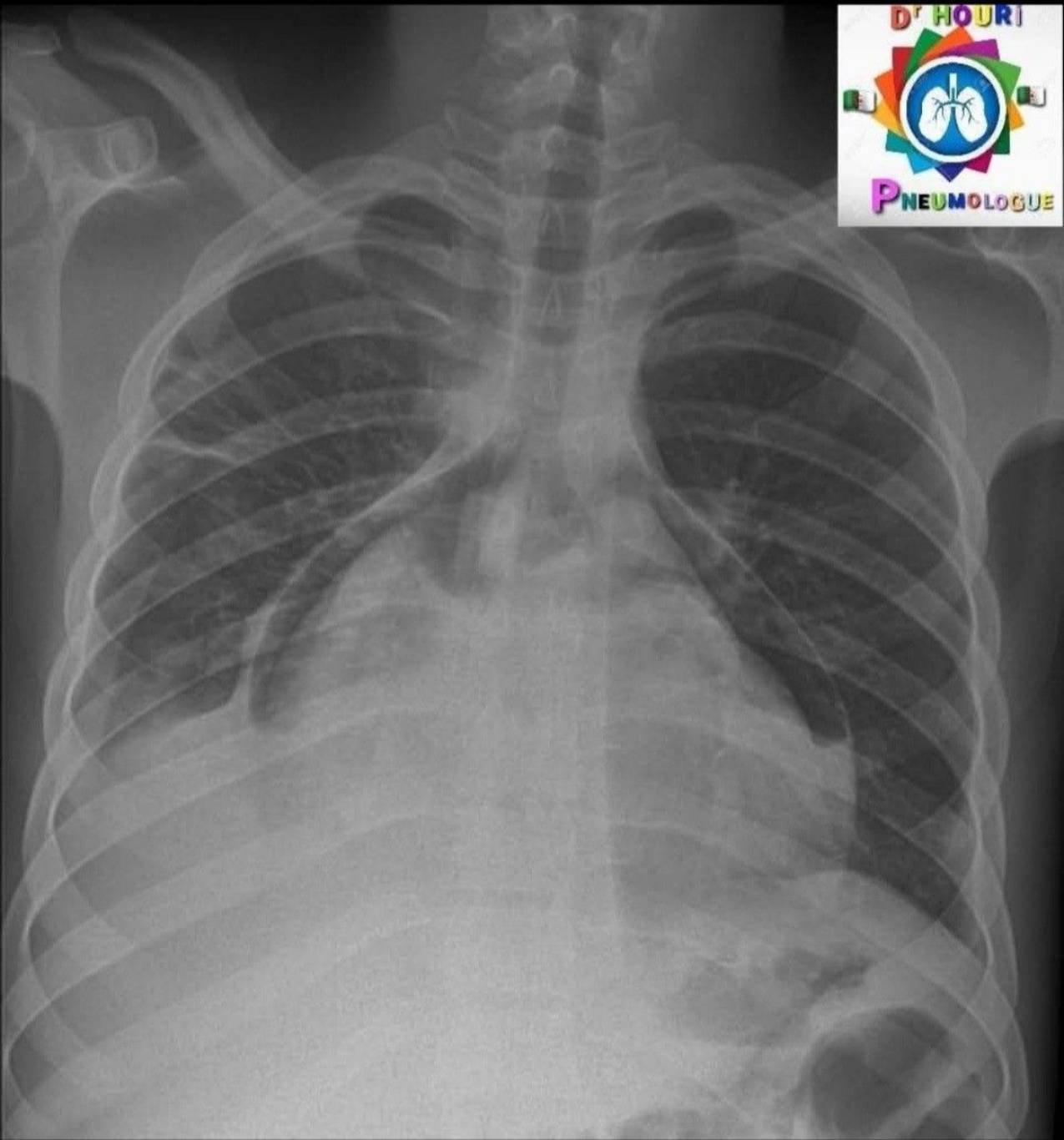 Radiologie 84