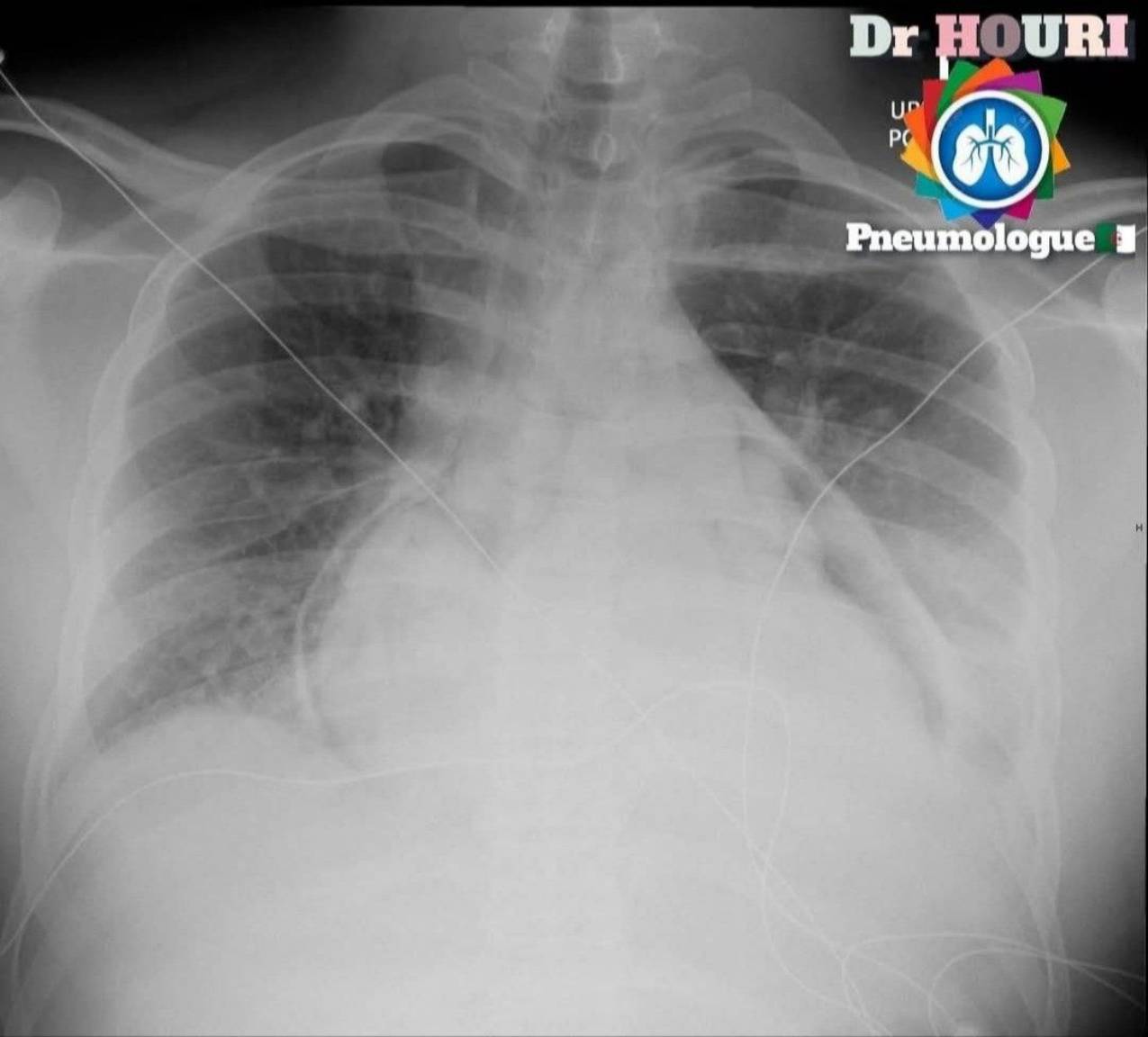 Radiologie 85