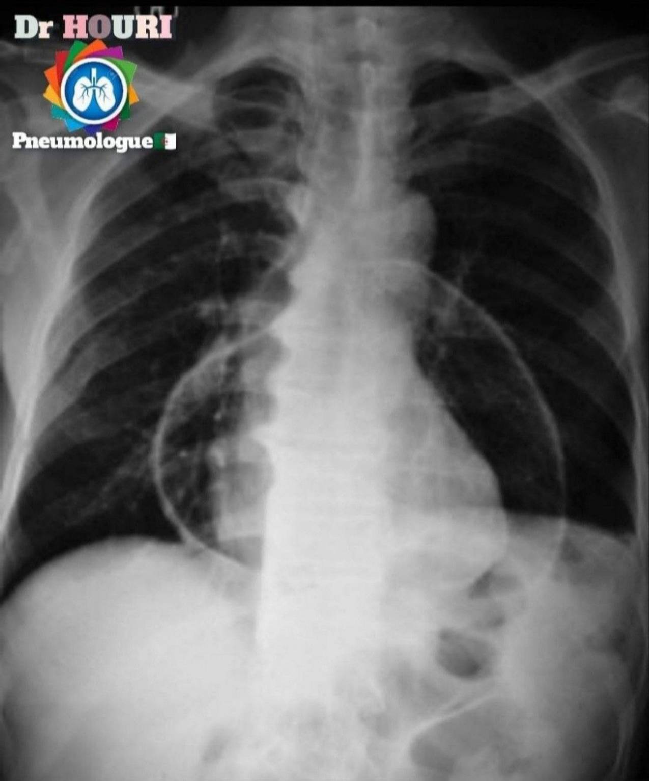 Radiologie 86