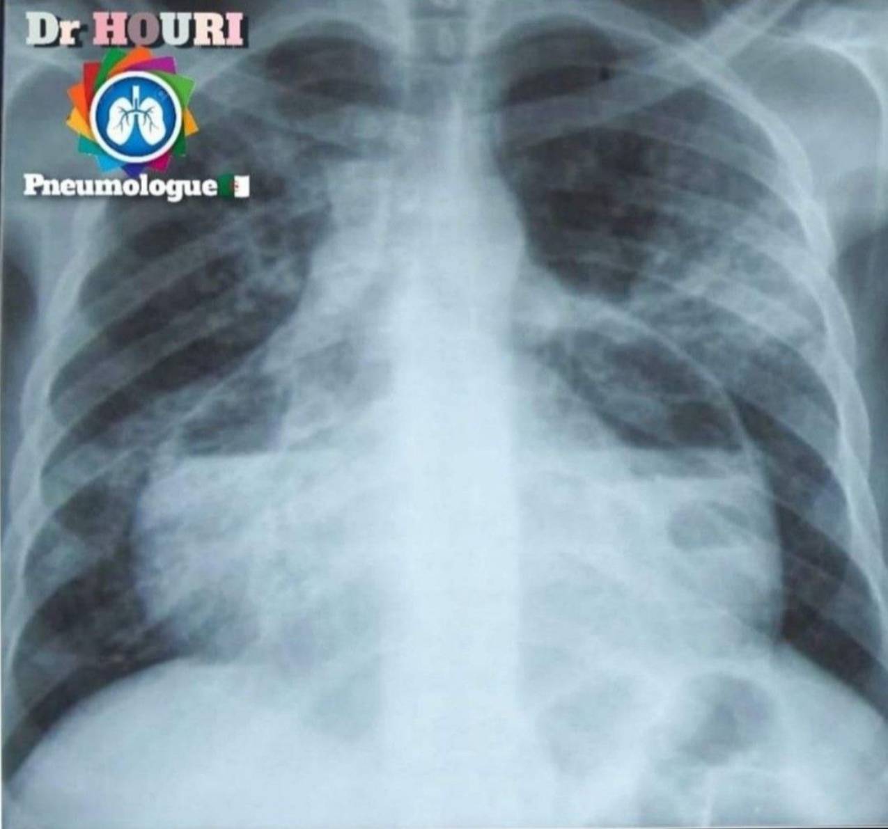 Radiologie 87